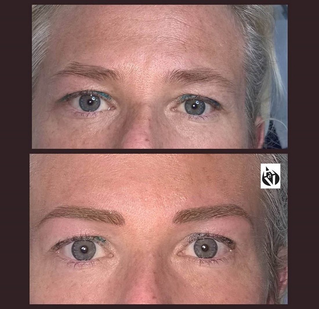 Sopracciglia chiare e rade prima del trucco permanente, e sotto le stesse sopracciglia ridisegnate e riempite